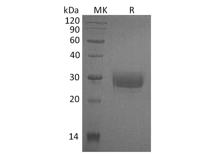 Recombinant Human CD32a/FCGR2A Protein (H131, His Tag) - image 1