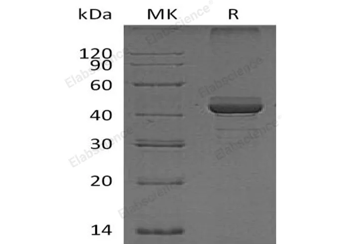 Recombinant Human FIBP Protein - image 1