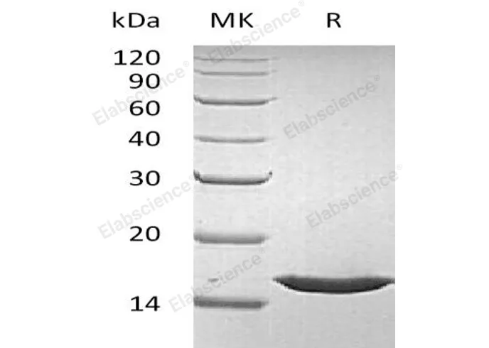 Recombinant Human FGF-1/FGFa Protein - image 1