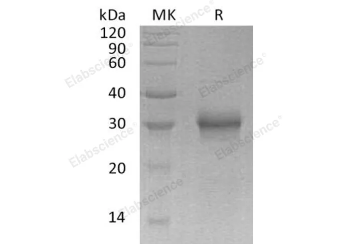 Recombinant Human FGF-17 Protein (His Tag) - image 1