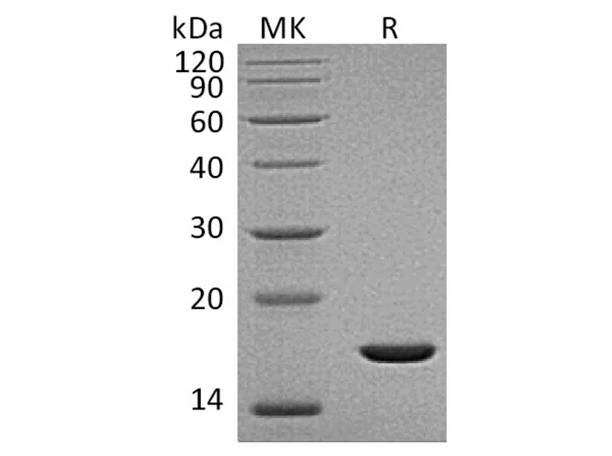 Recombinant Human FGF-2/FGFb Protein (aa 132-288) - image 1