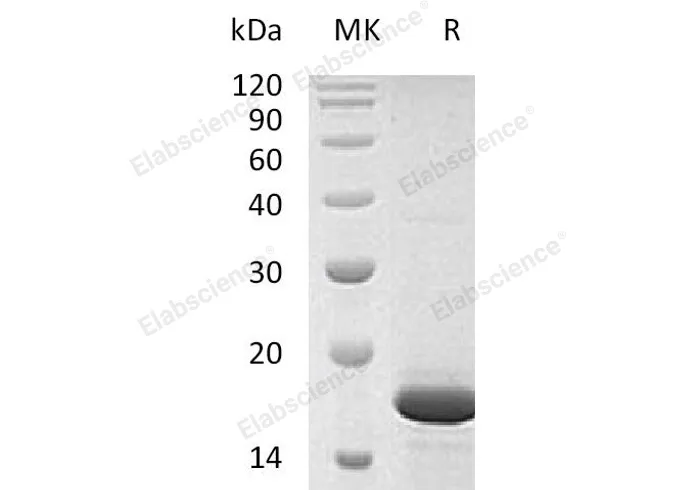 Recombinant Human FGF-2/FGFb Protein (aa 143-288) - image 1