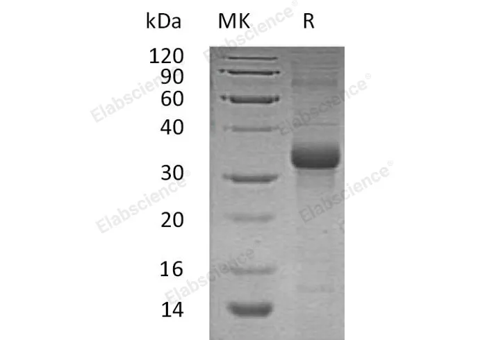 Recombinant Human FSTL1 Protein - image 1