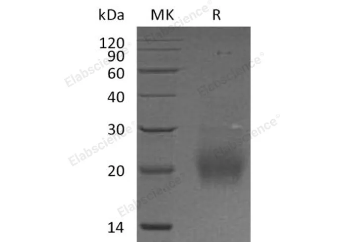 Recombinant Human Follitropin Subunit β/FSHB Protein (His Tag) - image 1