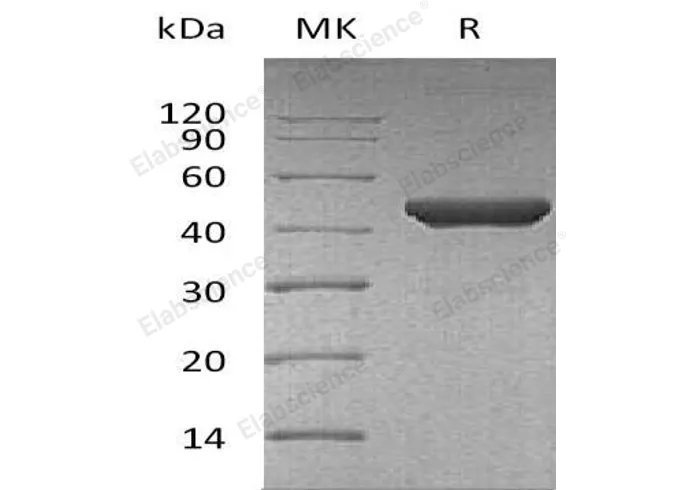 Recombinant Human Fumarase/FH Protein - image 1
