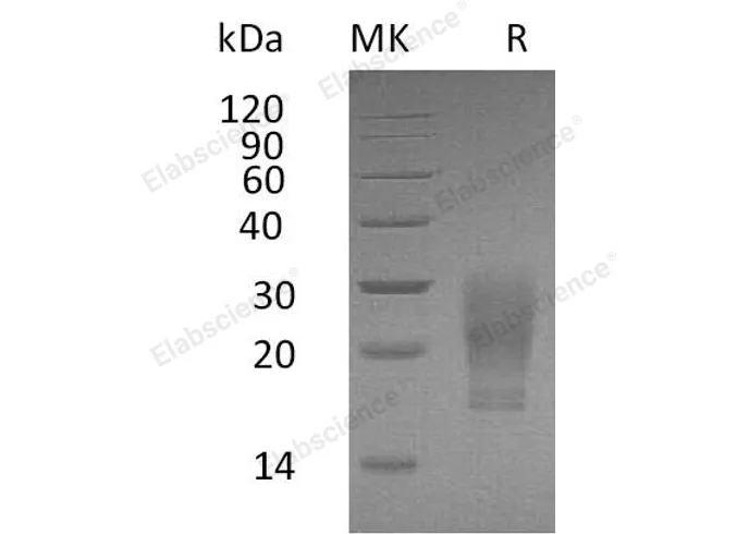 Recombinant Human GM-CSF/CSF2 Protein (His Tag, Cells) - image 1