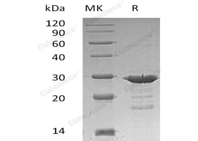 Recombinant Human GRB2 Protein (His Tag) - image 1