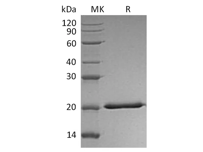 Recombinant Human Interferon Lambda-2/IL-28A Protein (His Tag) - image 1