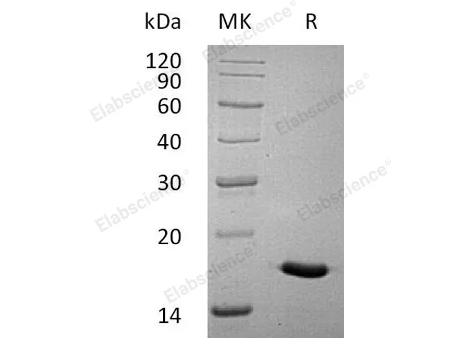 Recombinant Human Interleukin-17A/IL-17A Protein - image 1