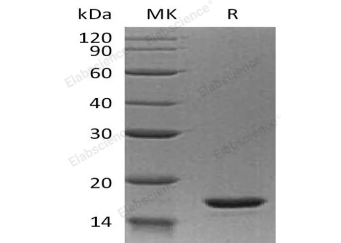 Recombinant Human Interleukin-20/IL-20 Protein - image 1