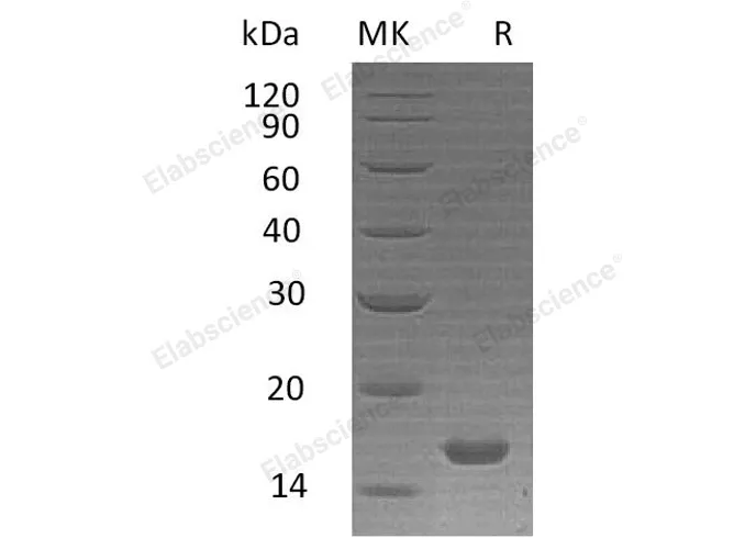 Recombinant Human Interleukin-21/IL-21 Protein - image 1