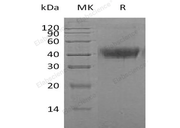 Recombinant Human M-CSF/CSF1 Protein (His Tag) - image 1