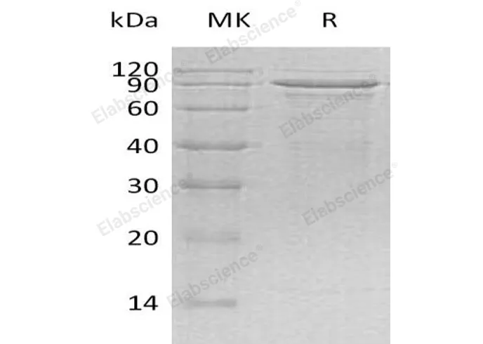 Recombinant Human MECP2 Protein (His Tag) - image 1