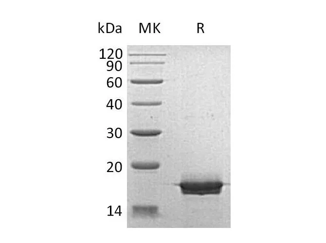 Recombinant Human MOG Protein (E.coli, His Tag) - image 1