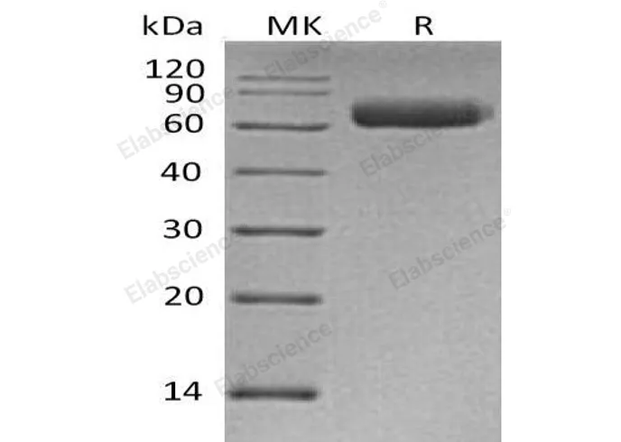 Recombinant Human NgR3/RTN4RL1 Protein (His Tag) - image 1