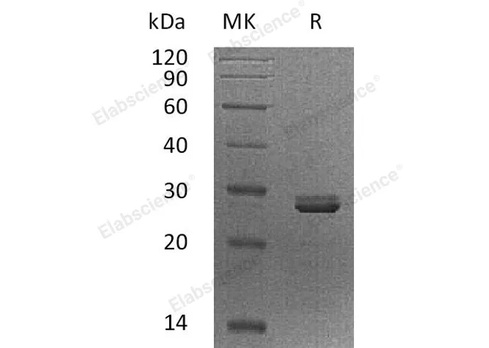 Recombinant Human PDCD10/TFAR15 Protein - image 1