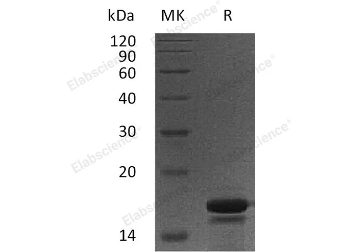 Recombinant Human PDCD5/TFAR19 Protein (His Tag) - image 1
