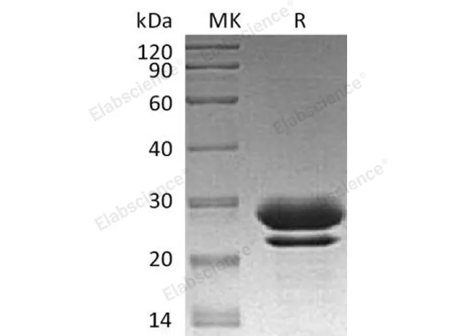 Recombinant Human PPIase/FKBP7 Protein (aa 24-222, His Tag) - image 1