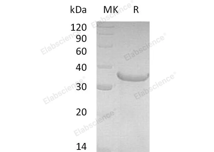 Recombinant Human Pro-Neuregulin-1/NRG1-β1 Protein (aa 2-246) - image 1