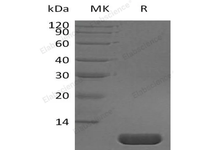 Recombinant Human Pro-Neuregulin-1/NRG1-β1 Protein (aa 177-241) - image 1