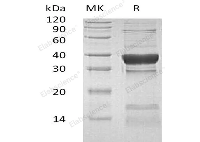 Recombinant Human PPP1CC Protein (His Tag) - image 1