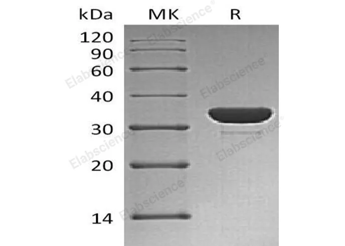 Recombinant Human PTPN6/SH-PTP1 Protein (His Tag) - image 1