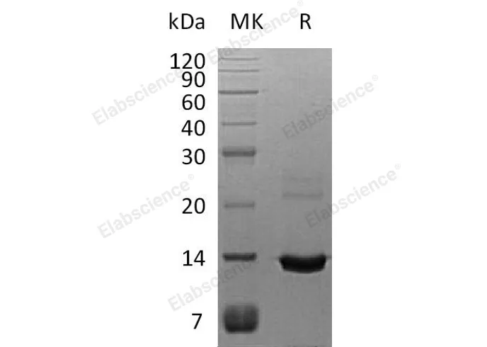 Recombinant Human S100A8 Protein (His Tag) - image 1