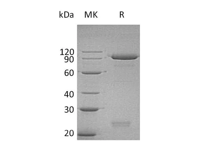 Recombinant Human Semaphorin 3C/SEMA3C Protein (His Tag) - image 1