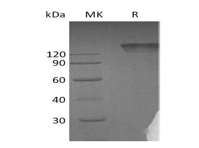 Recombinant Human Semaphorin 4D/SEMA4D Protein (Fc Tag) - image 1