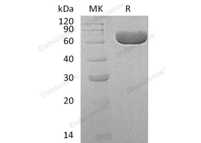 Recombinant Human SIAE Protein (Human Cells, His Tag) - image 1