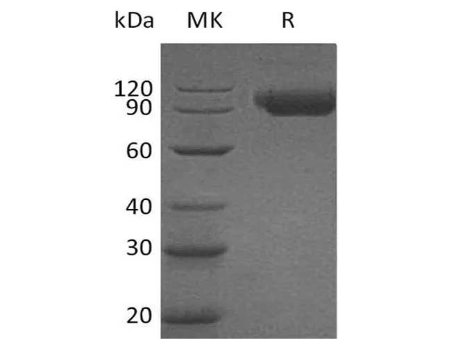 Recombinant Human SIGLEC9/CD329 Protein (Fc Tag) - image 1