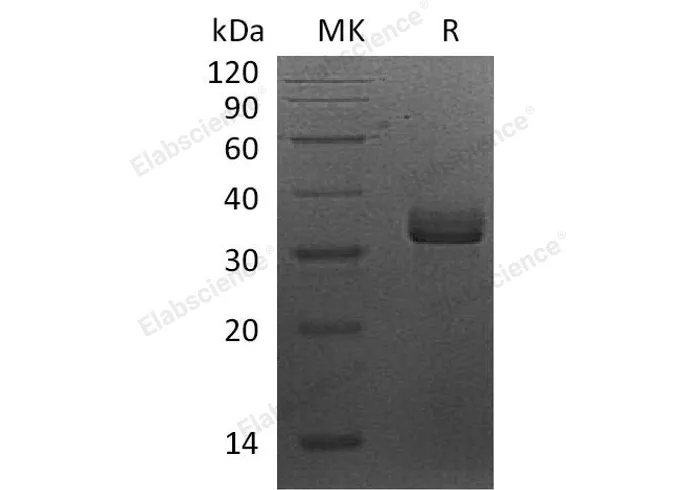 Recombinant Human Syntaxin-7/STX7 Protein (His Tag) - image 1