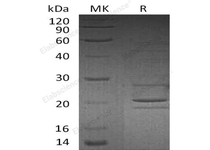 Recombinant Human Syntaxin-8/STX8 Protein - image 1