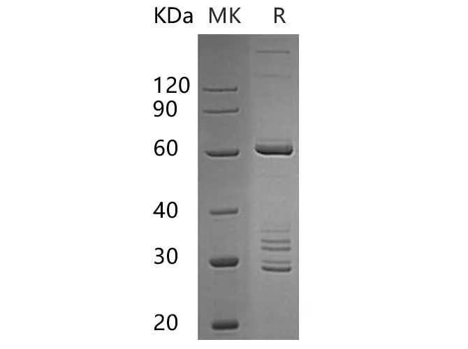 Recombinant Human TFIIB/GTF2B Protein (GST Tag) - image 1