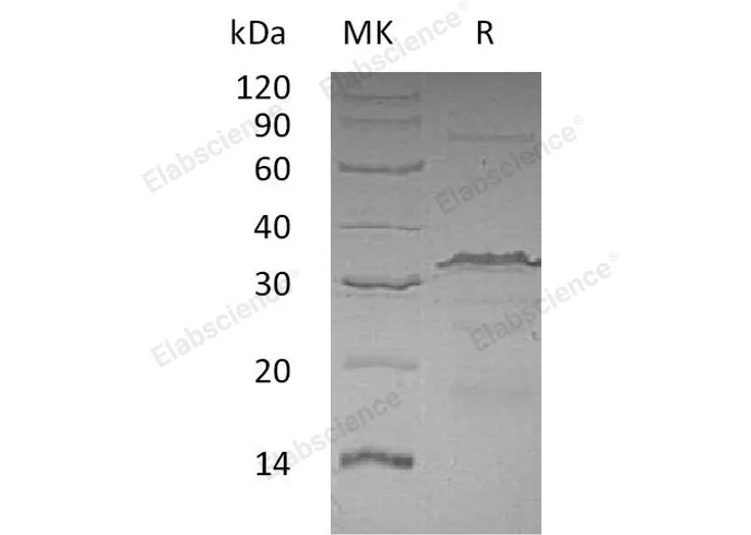 Recombinant Human CTCF Protein - image 1