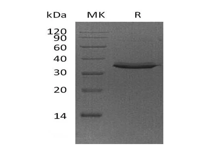 Recombinant Human FN14/TWEAKR Protein (Fc Tag) - image 1