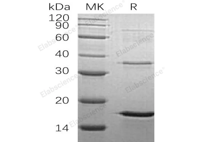 Recombinant Human LSM4 Protein (His Tag) - image 1