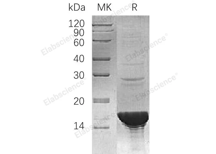 Recombinant Human UBE2B/HR6B Protein - image 1
