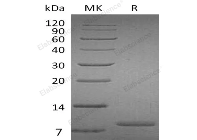 Recombinant Human UGRP1 Protein - image 1