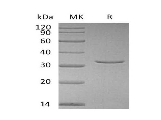 Recombinant Human VSNL1 Protein (His Tag) - image 1