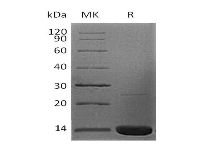 Recombinant Human Beta-2-Microglobulin/B2M Protein (E.coli, His Tag) - image 1