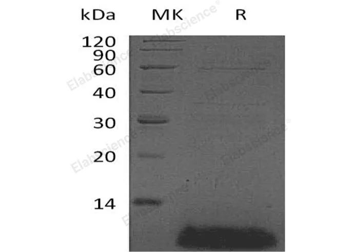 Recombinant Human β-Defensin 4A/DEFB4A Protein - image 1