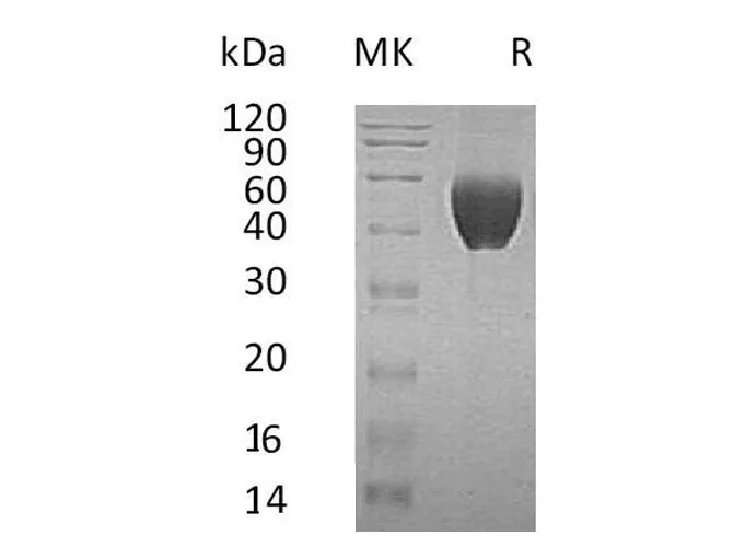 Recombinant Human FSTL1 Protein (His Tag, Human Cells) - image 1