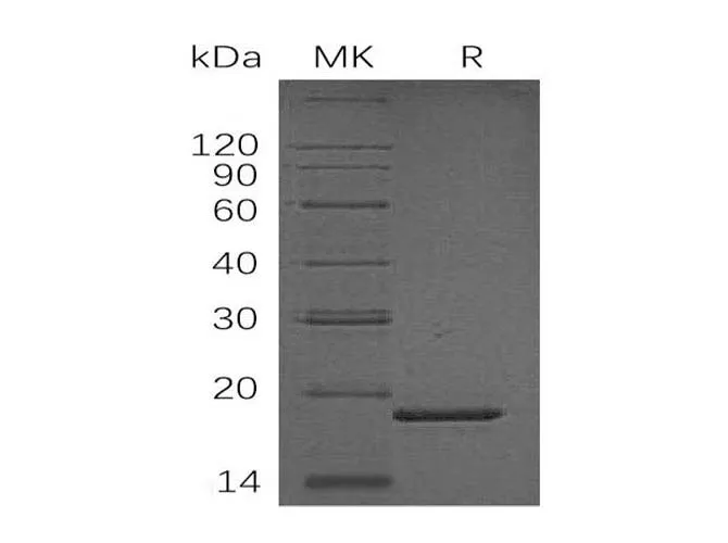 Recombinant Human PPIase/PPIL1 Protein (His Tag) - image 1