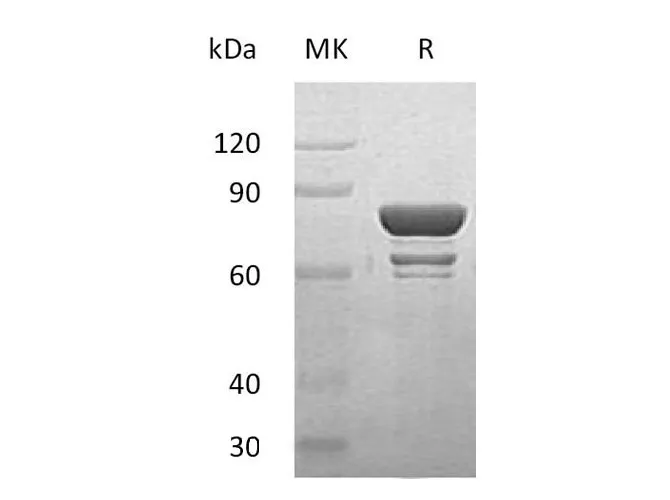 Recombinant Human STAT1 Protein - image 1