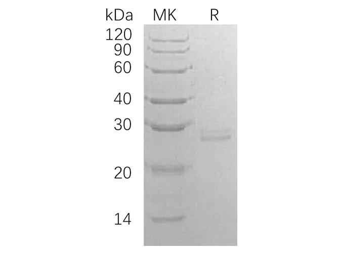 Recombinant Human RPE Protein (E.coli, His Tag) - image 1