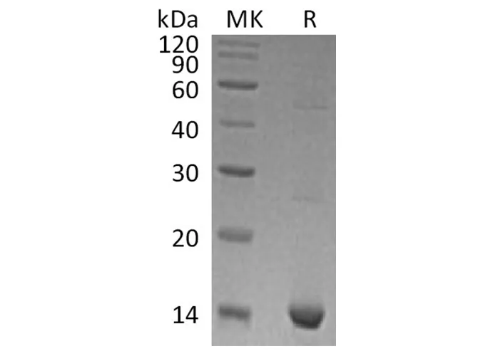Recombinant Human S100A9 Protein - image 1