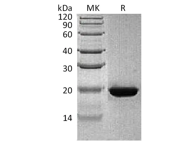Recombinant Human RBP4 Protein - image 1