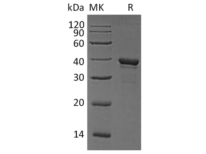Recombinant Human Arginase-1/ARG1 Protein (His Tag) - image 1