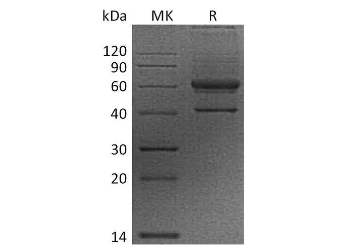 Recombinant Human VEGF-B/VEGFB Protein (Fc Tag) - image 1